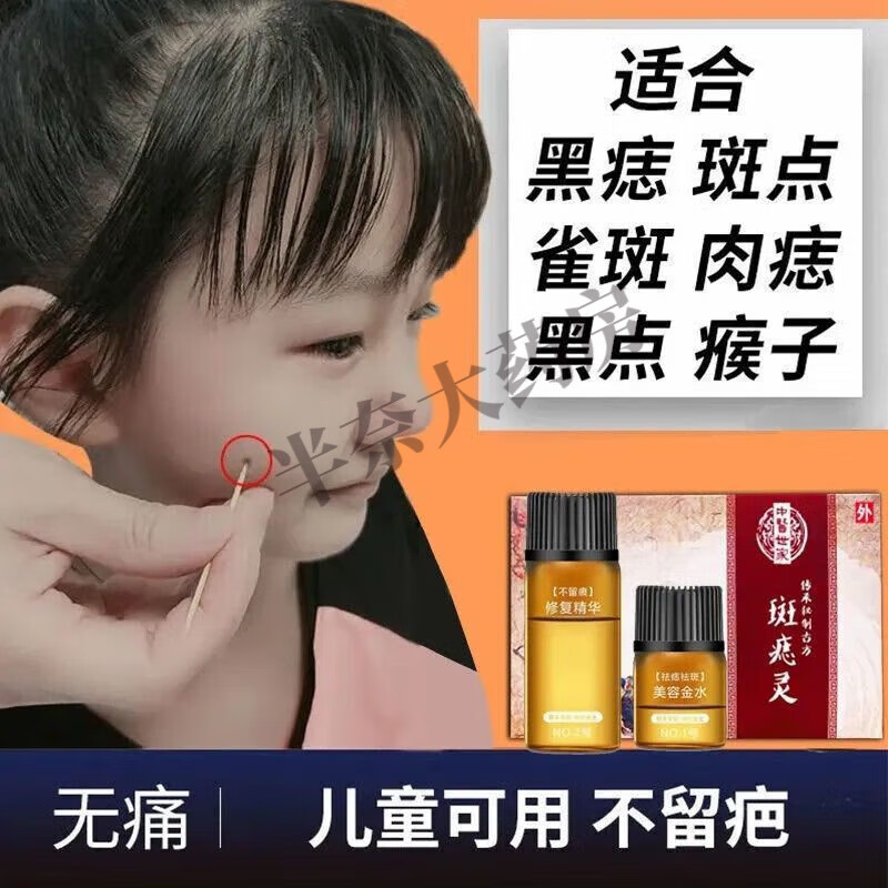 点斑无痕无痛水去痦子痣脱痣去脸上的黑痣贴 点痣水一瓶点痣点斑工具