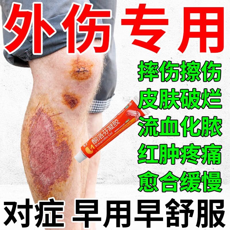 擦伤外用药 治跌打损伤 淤血肿痛擦伤摔伤皮肤破损红肿疼痛发炎流脓
