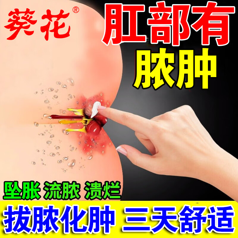 葵花肛周脓肿拔脓膏用药肛周有硬块脓肿术后护理肛瘘肛裂肛窦炎疼痛