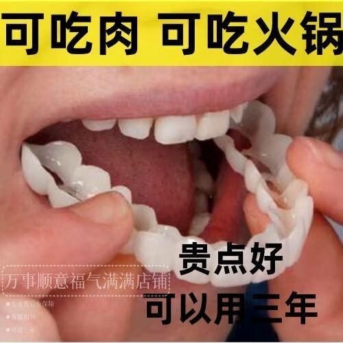 假牙填充缺牙牙缝补牙通用 可咬坚果 啃骨头 火锅 上牙 杜仲胶送收纳