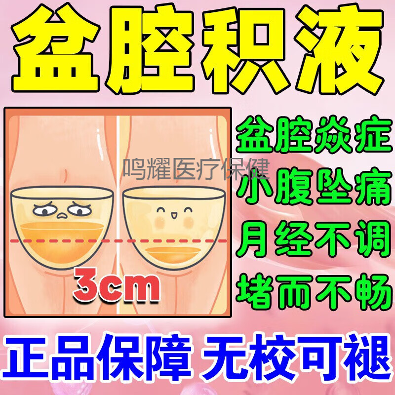 盆腔积液专用贴药下腹疼痛白带异常附件炎炎月经不调妇保贴 【单盒装