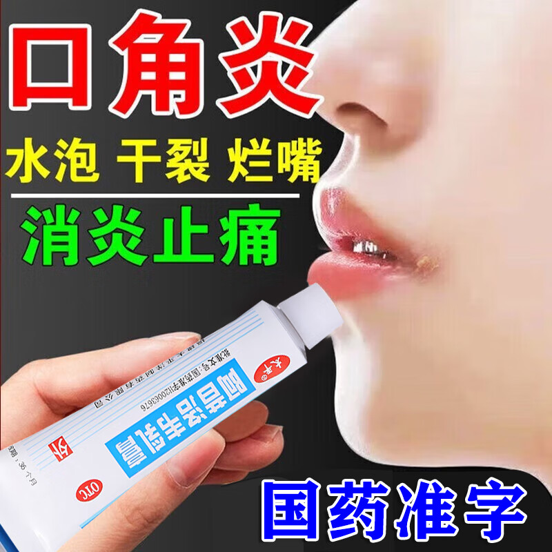 【疱疹外用药】烂嘴角药 疱疹感染引起的口角炎烂嘴角药膏治烂嘴药