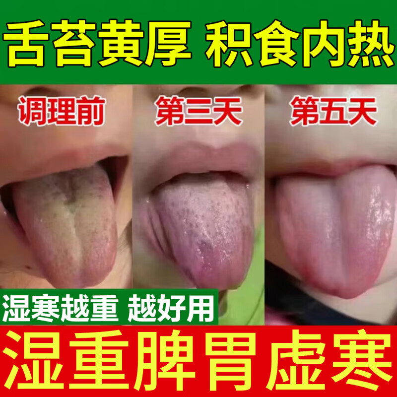 肚脐贴脾胃虚寒脾胃虚弱湿气重肝火旺盛除·湿调理脾胃肠祛·湿艾绒 一盒装【30粒+30贴】