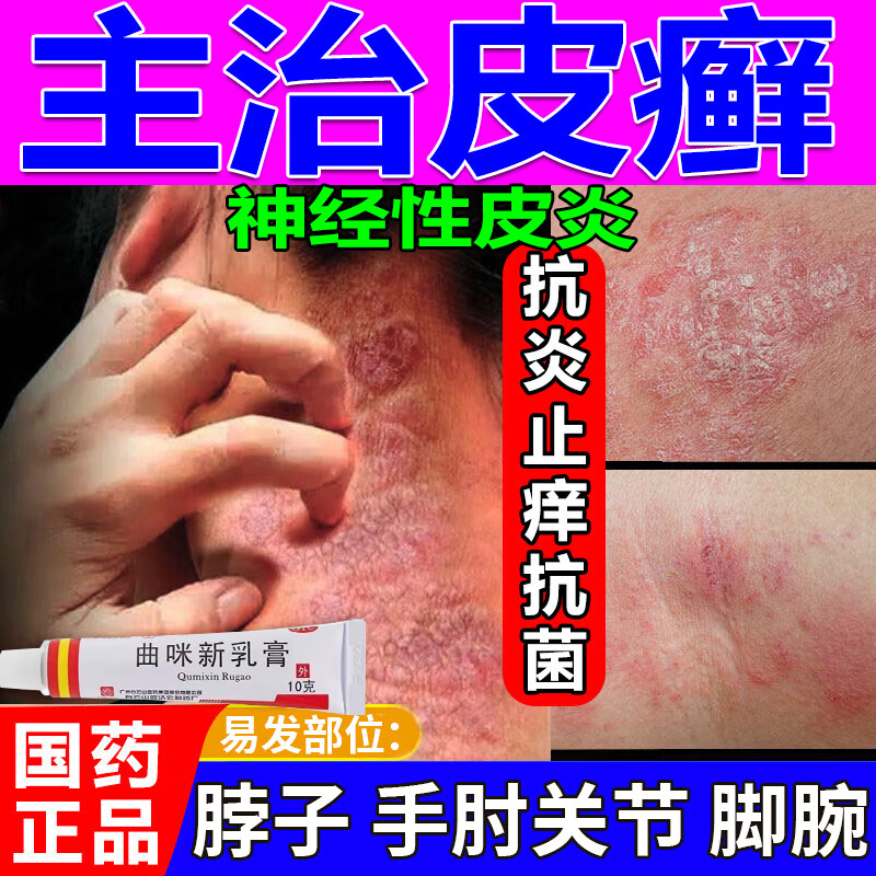 脖子上长的癣治疗神经性皮炎专用药顽固皮肤瘙痒抓出血抓成癣增厚皮炎