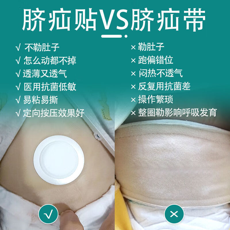 宝宝脐疝贴新生儿小儿疝气绷带氙气带婴幼儿气凸肚脐眼压疝包 1盒10贴