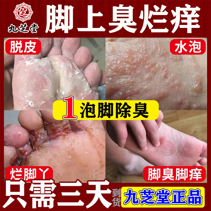 九芝堂足光散 足光散治脚气泡脚止痒脱皮 足光散治脚气泡脚止痒脱皮汗