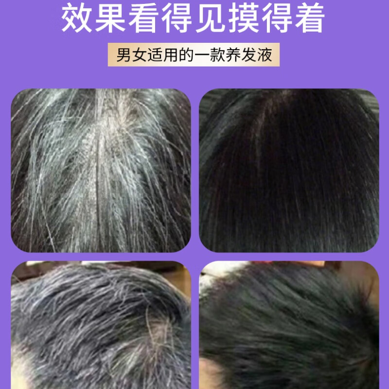 十麦九稻白发黑灵芝何首乌黑发精华液黑发养黑不用染正品  精华液2瓶+精华素1瓶