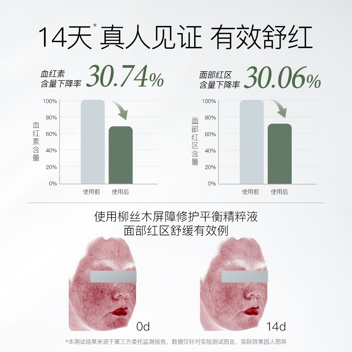 柳丝木（Ositree）降燥水 屏障修护平衡精粹液爽肤水滋润保湿温和舒缓褪红敏感肌 【敏肌降燥】150g