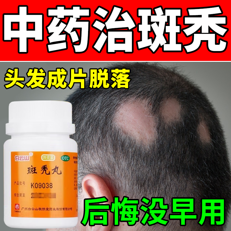 白云山斑秃丸水密丸35g治斑秃鬼剃头斑秃成片脱发头发稀少掉发生发