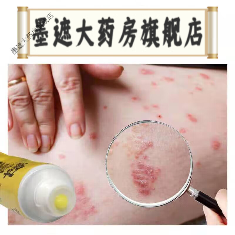 水一疥疮膏硫磺软膏20%疥疮皮肤丘疹水疱阴囊瘙痒性结节皮肤用药 单盒