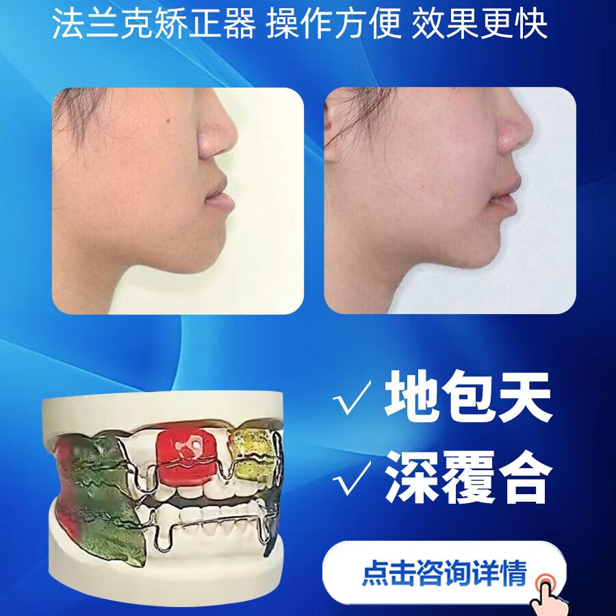 儿童牙齿夜间隐形矫正器法兰克3矫正器地包天龅牙钢丝牵引器扩弓器