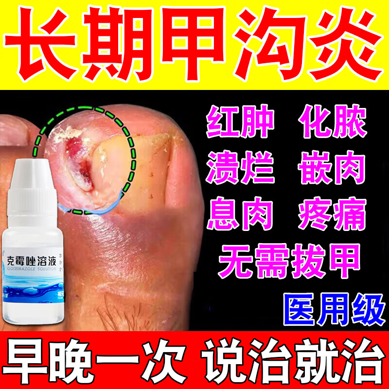 甲沟炎专用指甲长肉里刀消肿专用药去指甲根肉芽治嵌甲去除息肉指甲长
