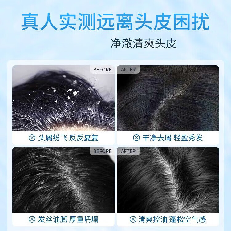 南京同仁堂二硫化硒清爽去屑洗发水控油蓬松清洁去头屑头痒儿童孕妇可用品牌 1瓶装【南京同仁堂品牌正品】500ml/瓶 【有防伪标识买的放心】