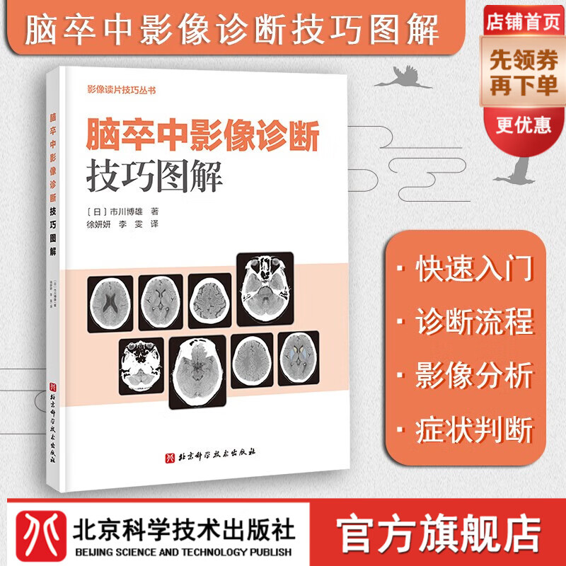 脑卒中影像诊断技巧图解 影像诊断 读片技巧 影像解剖 北京科