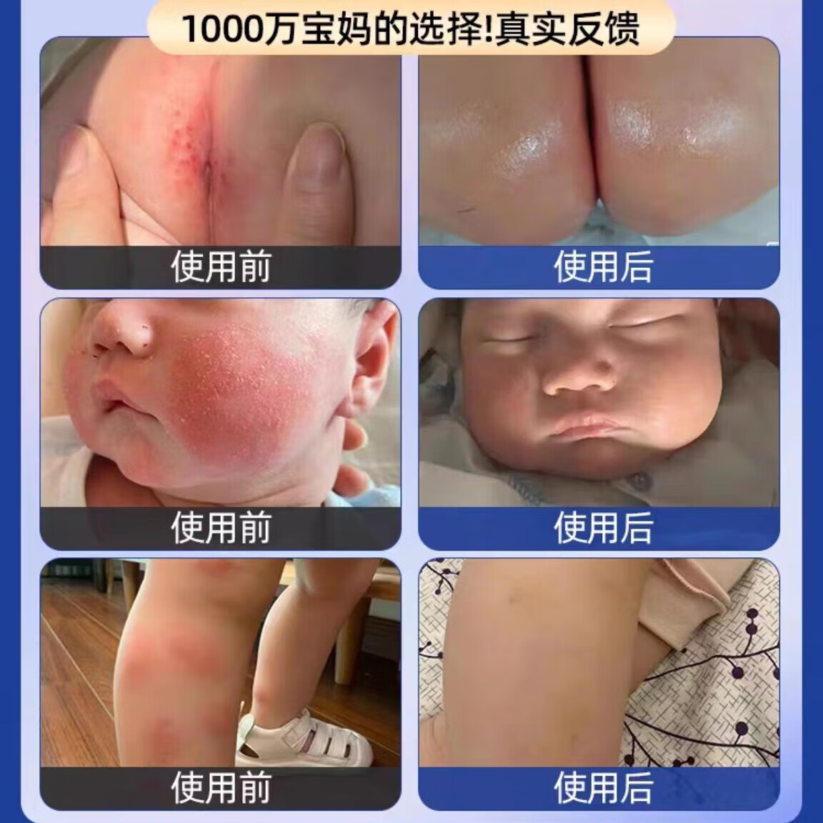 贝璞花抑菌膏婴亲霜老款抑菌霜草本婴儿湿痒专用奶藓红屁屁膏宝宝红痒霜 90g 3瓶 常规装 贝璞花抑菌膏