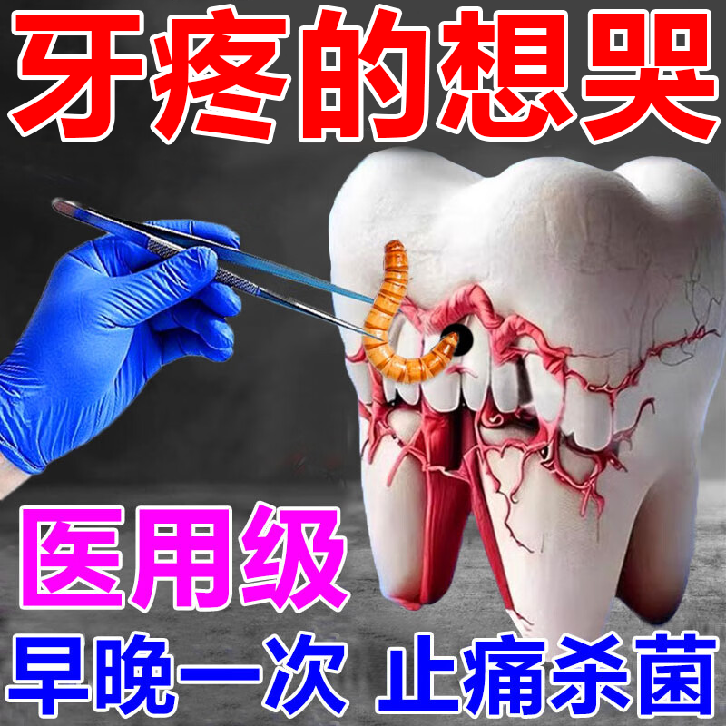 牙周炎特专效用药牙齿松动牙龈萎缩牙龈肿痛牙神经疼痛牙根疼蛀牙痛