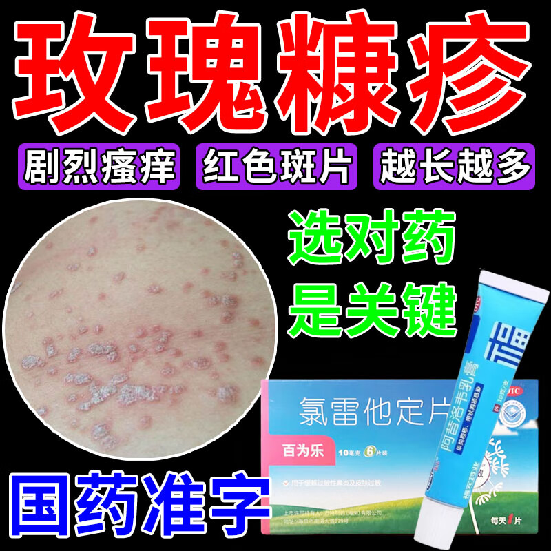 玫瑰糠疹用专药】治皮肤瘙痒皮炎湿疹丘疹性荨麻疹红斑鳞屑圆形斑疹