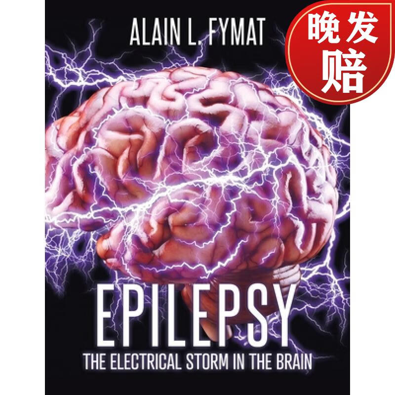 【4周达】epilepsy: the electrical storm in the brain