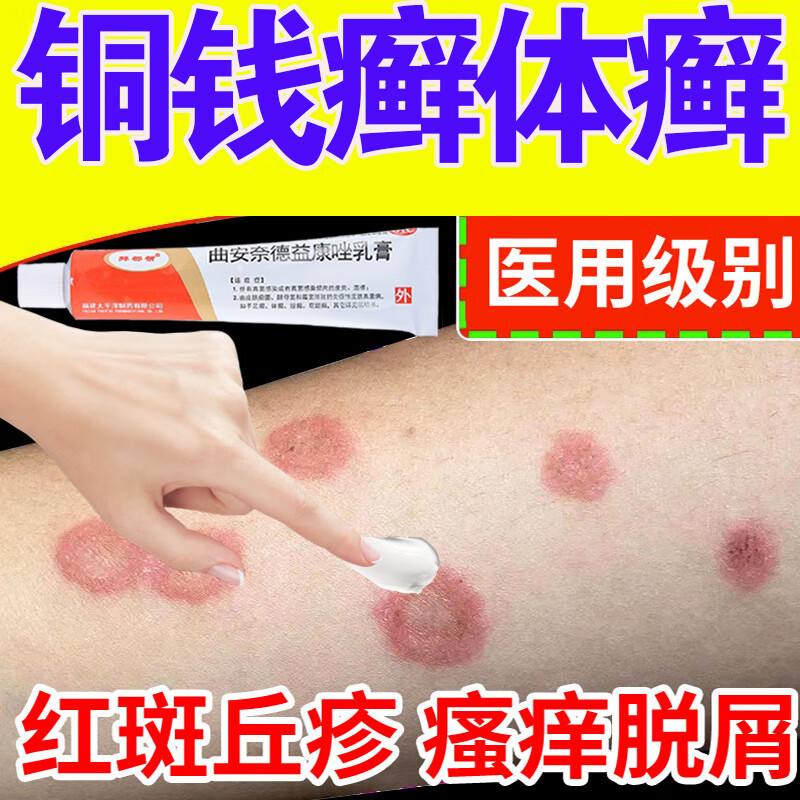 皮肤癣i药膏铜钱癣专用药膏体癣股癣治疗皮肤瘙痒真菌感染皮肤用药