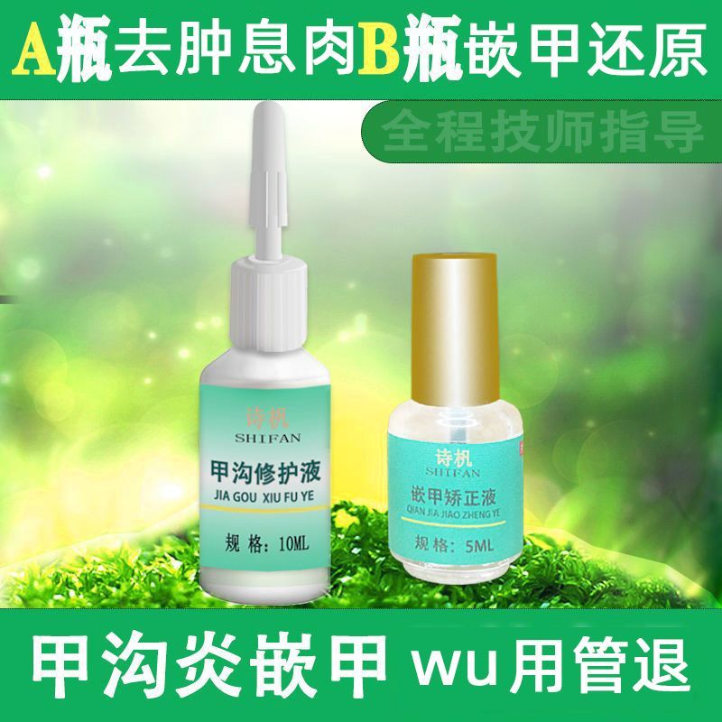 红肿息肉甲沟炎神器化脓脚趾甲往肉里扎痛矫正器 轻度甲沟炎加嵌甲