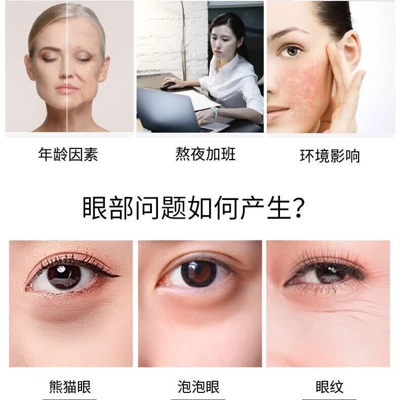 瞳话金苹果眼霜淡化细纹眼角纹鱼尾纹抗皱男女士护肤品大牌正品国货 金苹果抗皱眼霜 30ml