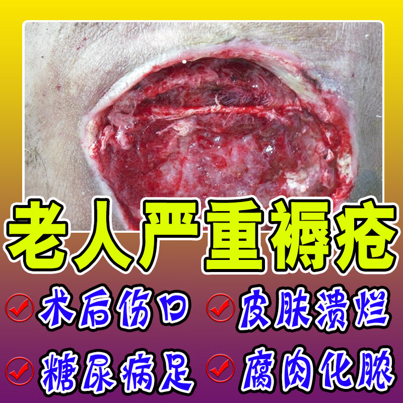 橡皮腐去生肌膏 伤口愈合同仁仁堂生肌膏长肉愈合伤口褥疮膏老人臀部
