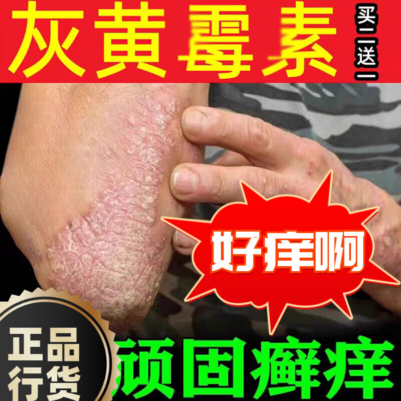 灰黄霉素软膏真菌感染灰头癣治头癣药灰黄霉素软膏灰黄霉素人用灰黄