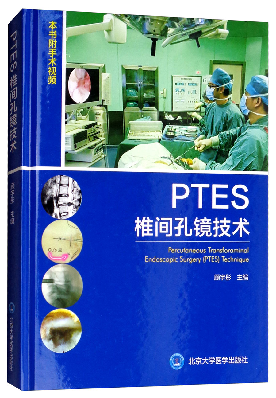 PTES椎间孔镜技术（附手术视频）