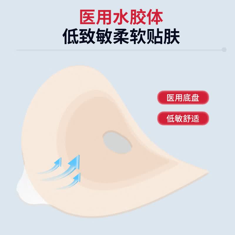 护士同学一件式微凸底盘造口袋一次性凸面可排气大便袋肛肠防凹陷造瘘袋 活性炭款【5片】微凸底盘+送棉签