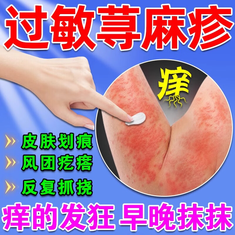 荨麻i疹过敏止痒瘙痒凝胶慢性荨麻l疹丘疹性皮肤水肿红斑手足癣皮肤