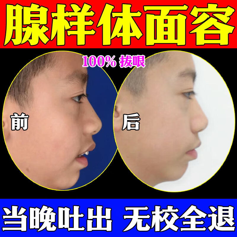 腺样体面容器 腺样体肥大中药贴儿童用药贴儿童张嘴呼吸s 1盒