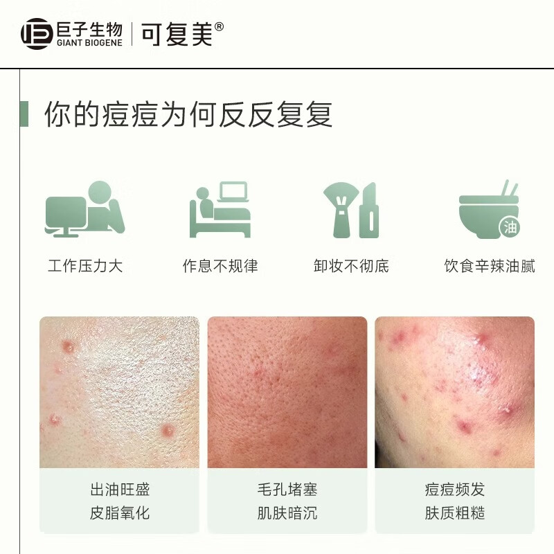 可复美小绿膜 净痘修护面膜 双酸修护 温和控痘 TK 小绿膜2片