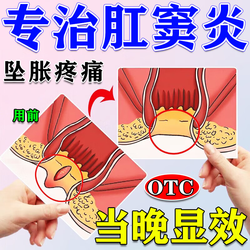 肛窦炎专用特i效药】治肛周炎肛门发炎红肿疼痛出血肛周脓肿囊肿屁眼