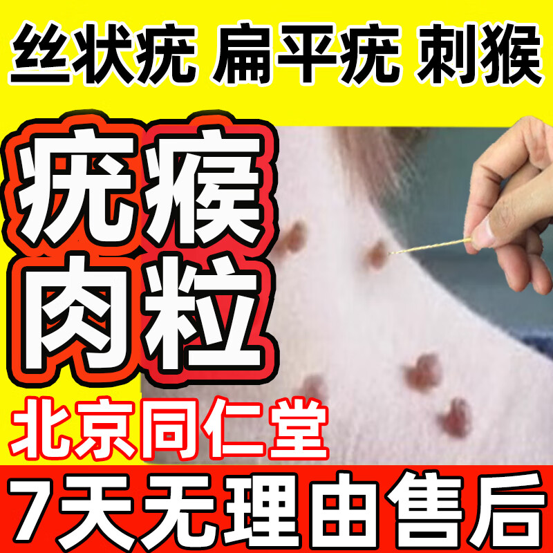 小肉粒去除膏扁平疣疣瘊专用膏肉粒扁平疣专用膏面部脖子祛扁平疣祛疣
