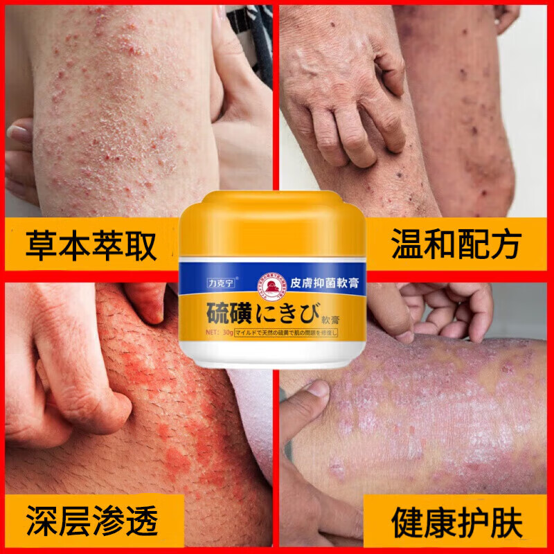 硫磺软膏阴虱私处专用阴囊瘙痒潮湿外阴肛门瘙痒膏屁眼痒夜间加重皮肤