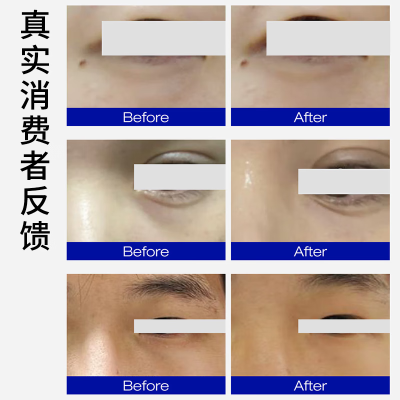 德玛森氏UP21多肽眼精华淡眼袋眼纹保湿提拉紧致嘭泪沟次抛眼胶眼油42粒