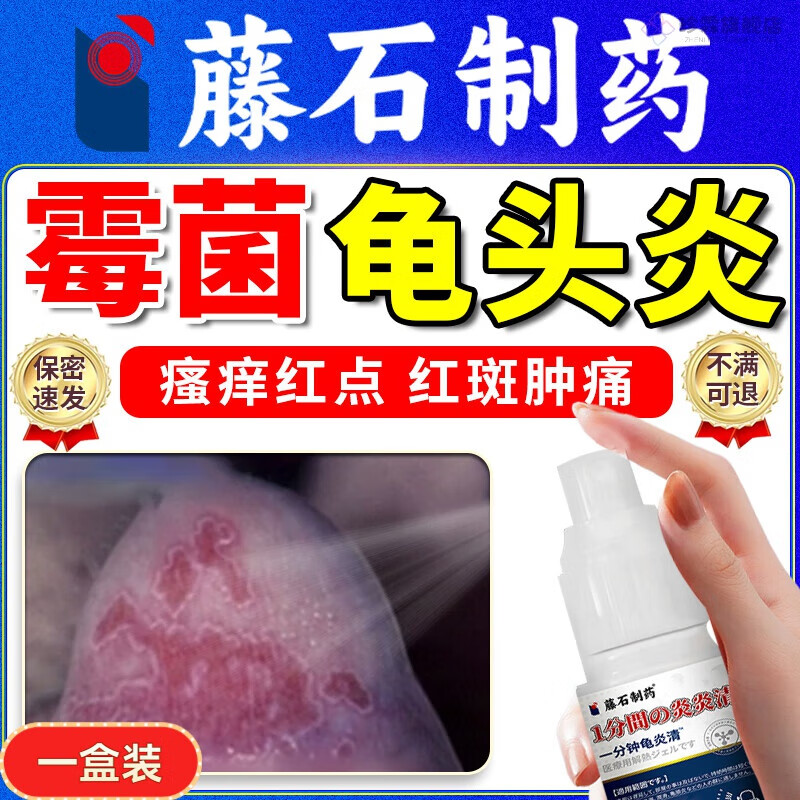 念珠菌男性包皮进口龟头炎真菌感染霉菌膏型红斑脱皮 单盒购买【建议