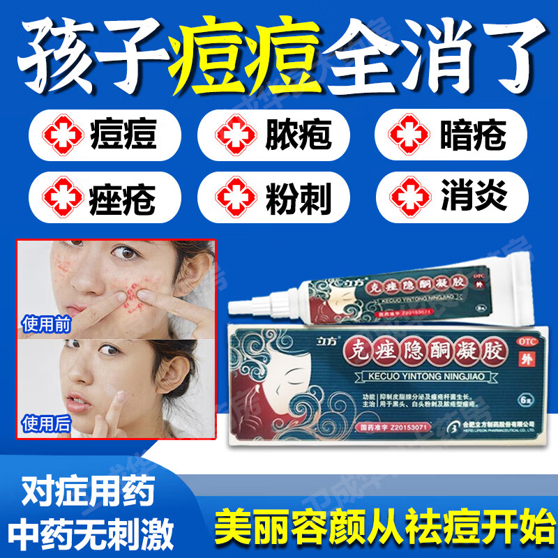 立方 克痤隐酮凝胶6g正品 祛痘消炎痤疮皮脂腺分泌导致的去黑头闭口