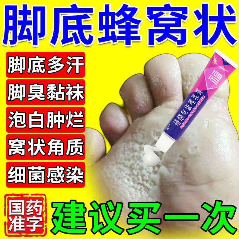 治脚气脚出汗脚底蜂窝状药膏 窝状角质松解症脚底发白蜂窝脚臭脚脱皮