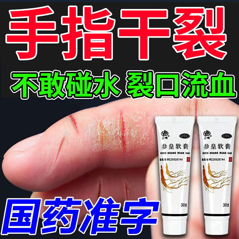 的手足皲裂手指开裂的药手指干裂药膏冬季冰口用药裂口干裂皲裂膏药膏