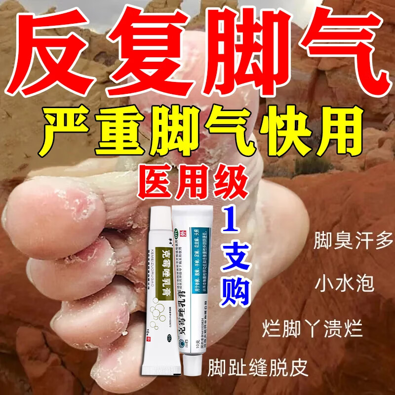 克霉唑 喷雾剂脚气膏脚气药止痒脱皮烂脚丫真菌感染止痒专用根药治脚