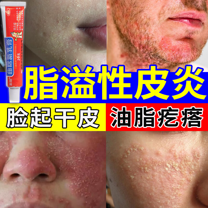 脂溢性皮炎专用药】面部鼻子周围下巴脸上皮肤干燥起皮过敏红痒面部