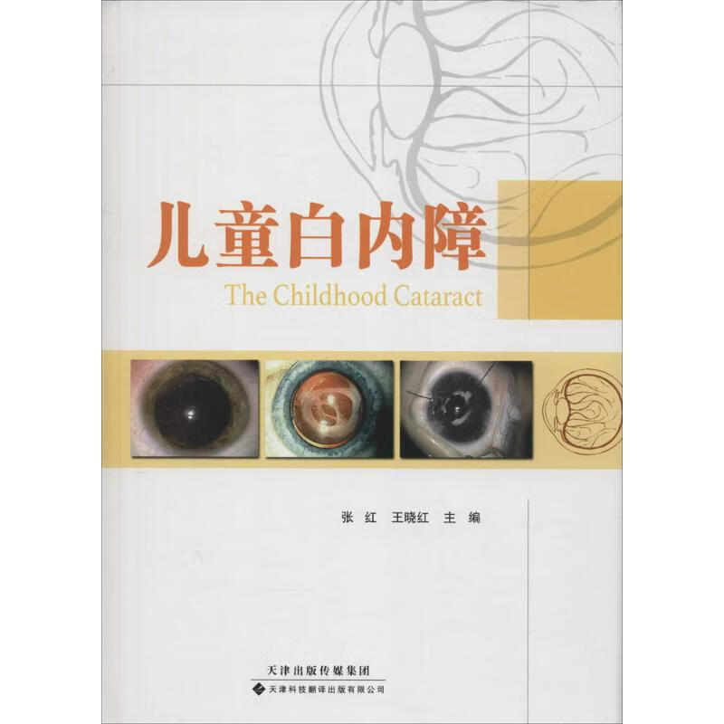 正版图书 儿童白内障