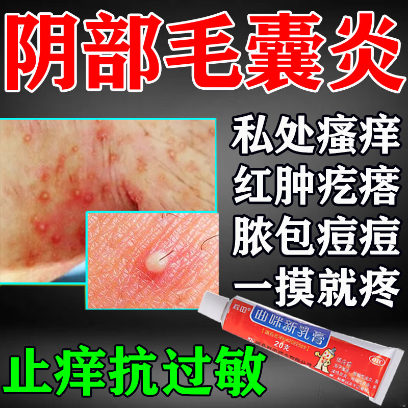 药专用药膏 男性女性阴部毛下瘙痒 私处真菌感染红肿有异味长疙瘩脓包