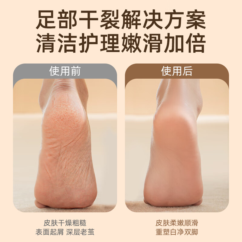 奥克斯AUX奥克斯电动磨脚器多档位全身水洗电动修足器美足电动修脚器充电式去死皮老茧刮脚皮后跟打磨足 【香槟金】重压感应+两档数显+强劲马力