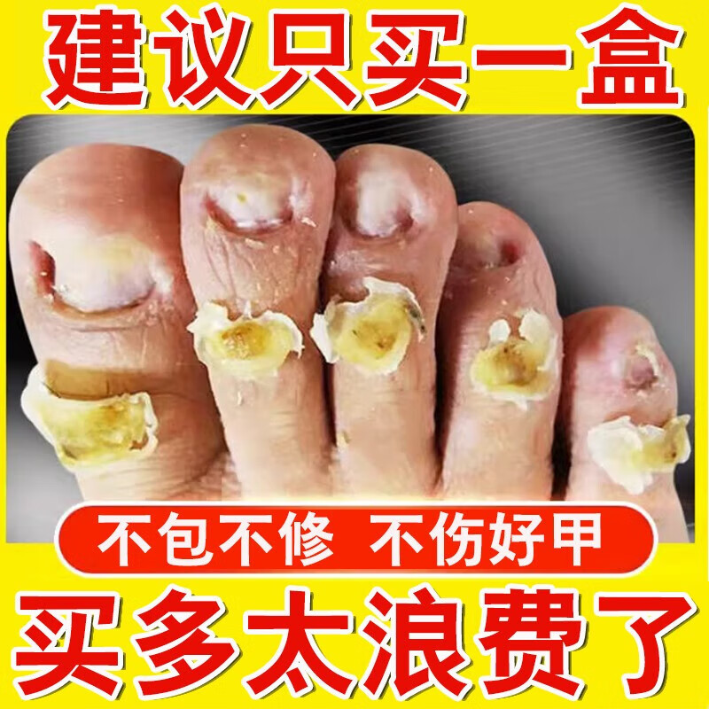 同仁堂(trt)领航奉献南京同仁堂灰指甲液护理盒增厚发黄变空脚趾甲本