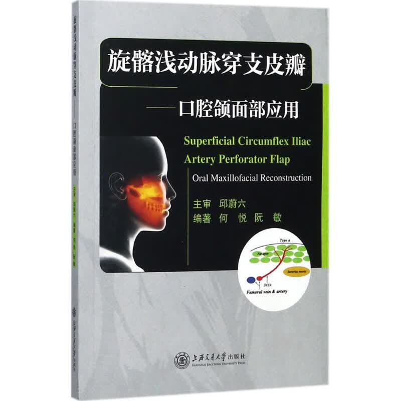 旋髂浅动脉穿支皮瓣