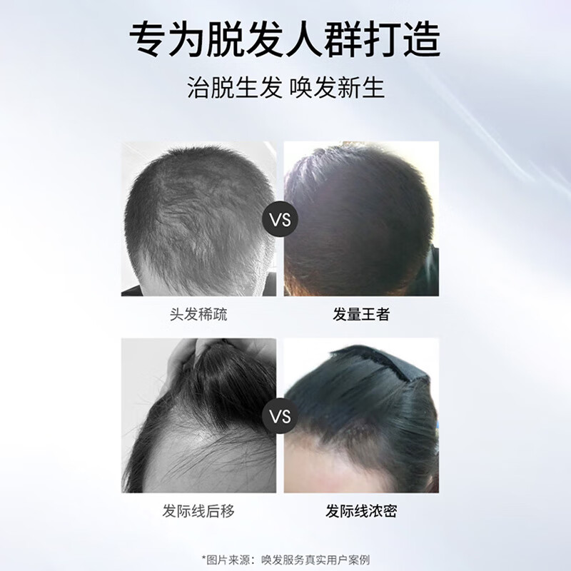 1盒2瓶】仁和 米诺地尔搽剂 5%*60ml*2瓶/盒 脱发生发液男专用防脱生发发际线增长液酊泡沫剂 1盒装【2个月周期初体验】