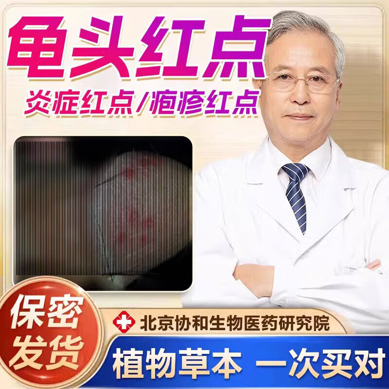 特傚效红点真菌霉菌感染龟i头治疗可搭的药膏珍珠念珠菌附睾炎瘙痒粒
