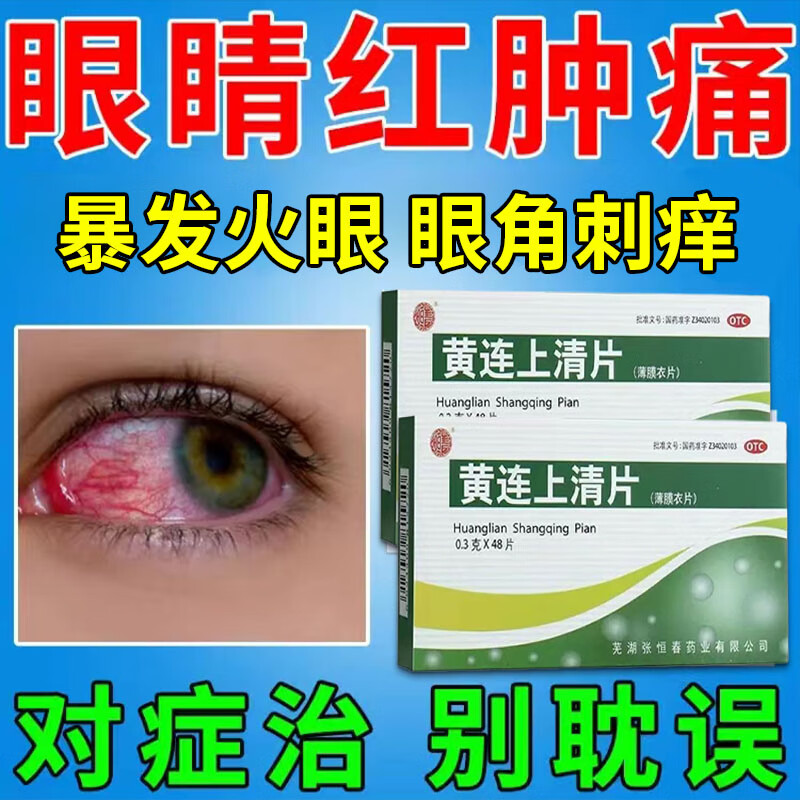 病中药眼睛红血丝红肿眼干眼涩眼屎多畏光流泪眼边刺痒结膜充血磨痛